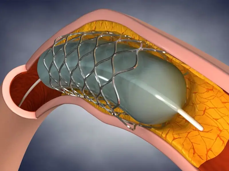 Surgical Animation